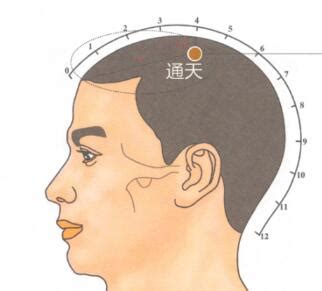 通天穴位
